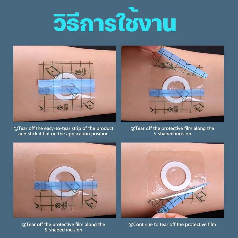 แผ่นแปะกลวงกันน้ำ แผ่นฝังจุดฝังเข็ม - 图片2