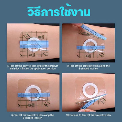 แผ่นแปะกลวงกันน้ำ แผ่นฝังจุดฝังเข็ม - 图片2